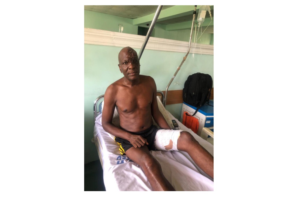 After successful Surgery